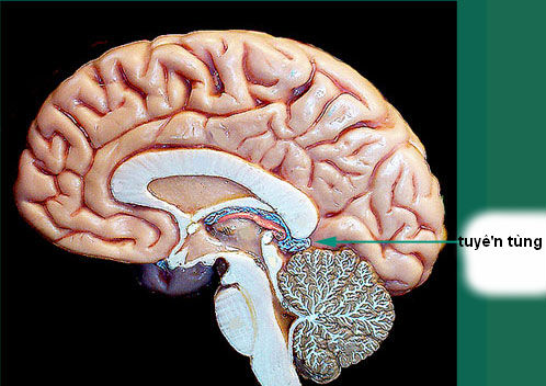 U vùng tuyến tùng (Pineal region tumours) U vùng tuyến tùng (Pineal region tumours)