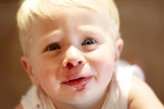 Cách nhận biết bệnh bạch cầu ở trẻ