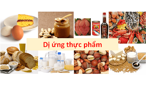 Dị ứng thực phẩm và những điều cần biết