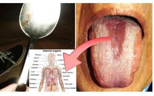 Kiểm tra hệ tiêu hóa chỉ bằng 1 chiếc thìa