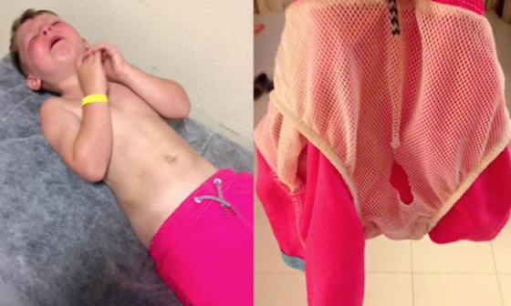 Giật mình với tai nạn đáng sợ của các bé trai mặc quần bơi lưới