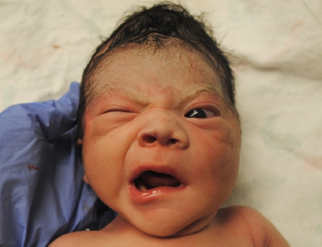 CẢNH BÁO: TRẺ sẽ BỊ MÉO MỒM, LIỆT MẶT do NẰM ĐIỀU HÒA LIÊN TỤC