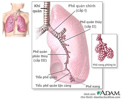 Chế độ ăn uống với người bị viêm phế quản