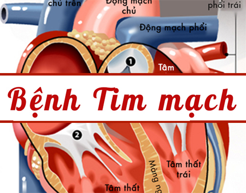 Thế nào gọi là bệnh tim mạch?