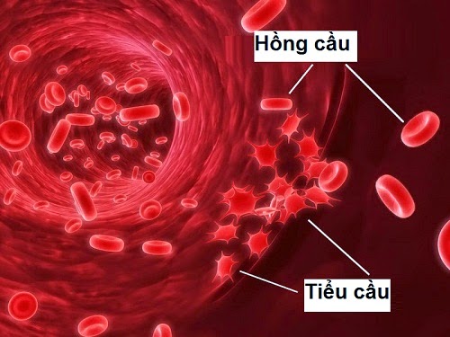 Hiểu biết về bệnh tăng tiểu cầu