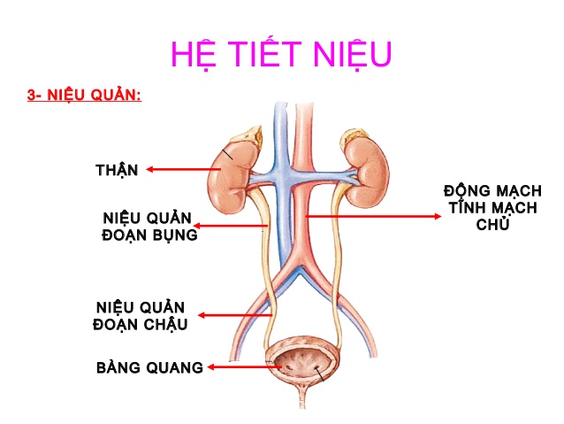 Phương pháp nhận biết sỏi niệu quản và những cách điều trị sỏi niệu quản mới nhất