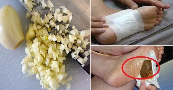 Giã nát tép tỏi đắp lên lòng bàn chân trước khi đi ngủ, điều kì diệu sẽ xuất hiện vào ngày hôm sau