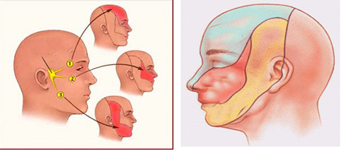 Ðau dây thần kinh số V và thuốc trị