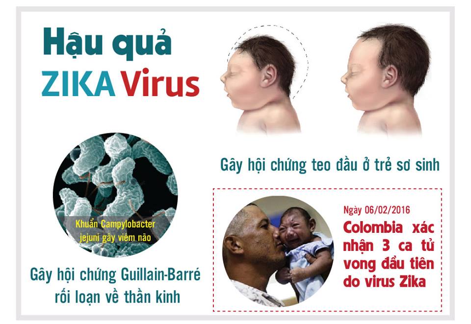 Tổng quan về hội chứng teo đầu ở trẻ sơ sinh (virus zika)