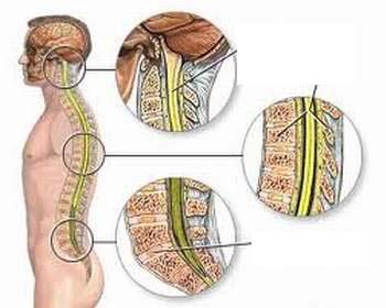 Những biến chứng thường gặp sau tổn thương tuỷ sống