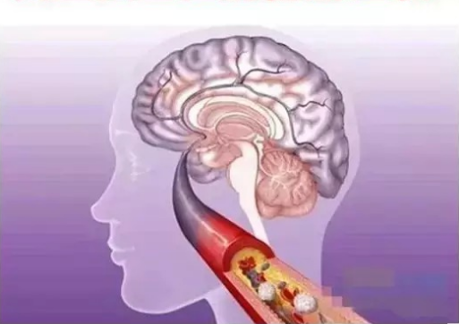 dinhduonghoc.com - xuat huyet nao