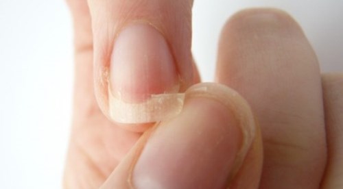 dinhduonghoc.com - 11 hiện tượng của móng tay ảnh hưởng tới sức khỏe