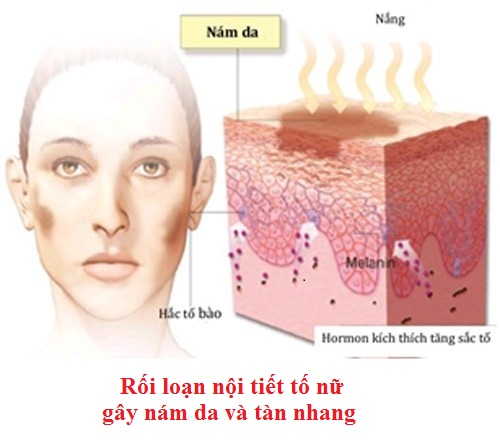 dinhduonghoc.com - roi loan tiet to nu