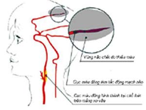 dinhduonghoc.com - hep dong mach canh