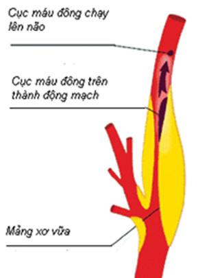 dinhduonghoc.com - hep dong mach canh