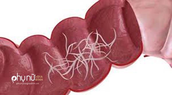 dinhduonghoc.com - nước tẩy giun cho trẻ