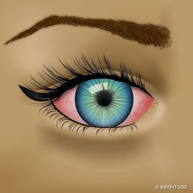 dinhduonghoc.com - 9 dấu hiệu bất thường ở mắt cảnh báo sức khỏe có vấn đề