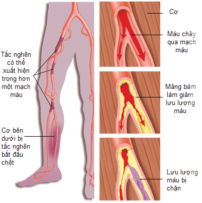 dinhduonghoc.com - Nguyên nhân gây tuần hoàn máu kém ở người trẻ tuổi