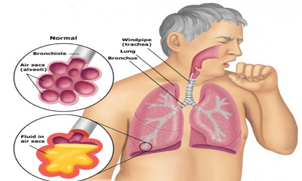 dinhduonghoc.com - Đông y và bệnh lao phổi