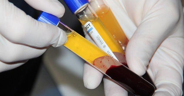 dinhduonghoc.com - Huyết tương của người trẻ giúp chống lão hóa và kéo dài tuổi thọ
