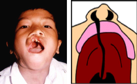 dinhduonghoc.com - Nguyên nhân gây tuần hoàn máu kém ở người trẻ tuổi
