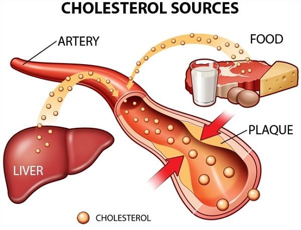dinhduonghoc.com - Tổng quát về chứng cao cholestrerol
