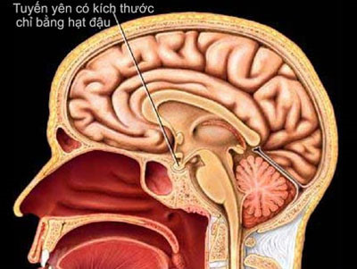 dinhduonghoc.com - U tuyến yên rất dễ nhầm với các loại bệnh khác!