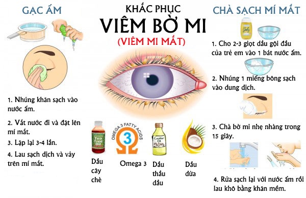 dinhduonghoc.com - Viêm bờ mi, bệnh gây kích thích mắt và ngứa
