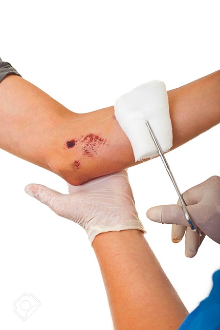 dinhduonghoc.com - Bệnh uốn ván và phương pháp điều trị