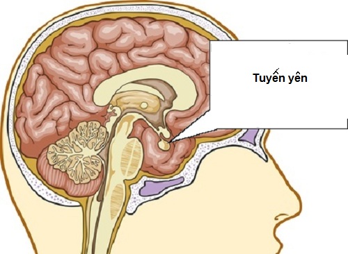 dinhduonghoc.com - U tuyến yên rất dễ nhầm với các loại bệnh khác!