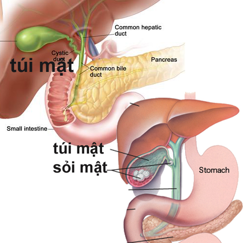 dinhduonghoc.com - tri soi mat