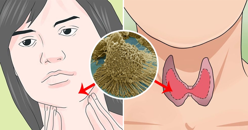 dinhduonghoc.com - những loại ung thư có khả năng chữa khỏi