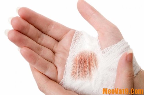 dinhduonghoc.com - những cách cầm máu tốt nhất